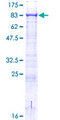 ACSBG2 Protein - 12.5% SDS-PAGE of human ACSBG2 stained with Coomassie Blue