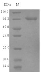 ACSF2 Protein - (Tris-Glycine gel) Discontinuous SDS-PAGE (reduced) with 5% enrichment gel and 15% separation gel.