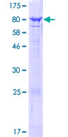 ACSF2 Protein - 12.5% SDS-PAGE of human ACSF2 stained with Coomassie Blue