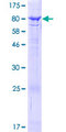 ACSF2 Protein - 12.5% SDS-PAGE of human ACSF2 stained with Coomassie Blue