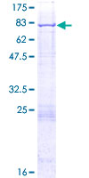 ACSF3 Protein - 12.5% SDS-PAGE of human ACSF3 stained with Coomassie Blue