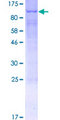 ACSL3 Protein - 12.5% SDS-PAGE of human ACSL3 stained with Coomassie Blue