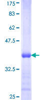 ACSL3 Protein - 12.5% SDS-PAGE Stained with Coomassie Blue.
