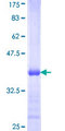 ACSL3 Protein - 12.5% SDS-PAGE Stained with Coomassie Blue.