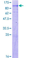 ACSL4 / FACL4 Protein - 12.5% SDS-PAGE of human ACSL4 stained with Coomassie Blue