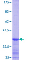 ACSL4 / FACL4 Protein - 12.5% SDS-PAGE Stained with Coomassie Blue.