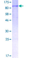 ACSL6 Protein - 12.5% SDS-PAGE of human ACSL6 stained with Coomassie Blue