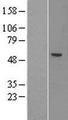 ACSM1 Protein - Western validation with an anti-DDK antibody * L: Control HEK293 lysate R: Over-expression lysate