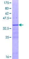ACSM1 Protein - 12.5% SDS-PAGE Stained with Coomassie Blue.