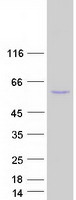ACSM2B Protein - Purified recombinant protein ACSM2B was analyzed by SDS-PAGE gel and Coomassie Blue Staining