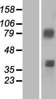 ACSM3 / SAH Protein - Western validation with an anti-DDK antibody * L: Control HEK293 lysate R: Over-expression lysate
