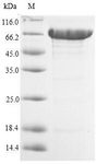 ACSS1 Protein - (Tris-Glycine gel) Discontinuous SDS-PAGE (reduced) with 5% enrichment gel and 15% separation gel.