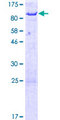 ACSS2 / ACAS2 Protein - 12.5% SDS-PAGE of human ACSS2 stained with Coomassie Blue