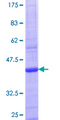 ACSS2 / ACAS2 Protein - 12.5% SDS-PAGE Stained with Coomassie Blue.