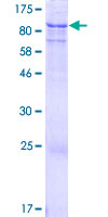 ACSS3 Protein - 12.5% SDS-PAGE of human ACSS3 stained with Coomassie Blue