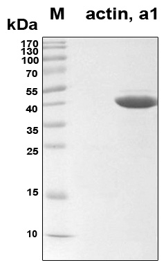 ACTA1 / Skeletal Muscle Actin Protein