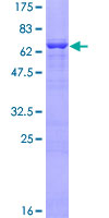 ACTA1 / Skeletal Muscle Actin Protein - 12.5% SDS-PAGE of human ACTA1 stained with Coomassie Blue