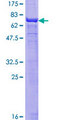 ACTA2 / Smooth Muscle Actin Protein - 12.5% SDS-PAGE of human ACTA2 stained with Coomassie Blue