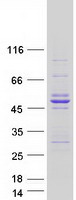 ACTA2 / Smooth Muscle Actin Protein - Purified recombinant protein ACTA2 was analyzed by SDS-PAGE gel and Coomassie Blue Staining