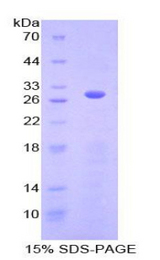 ACTC1 / Alpha Cardiac Actin Protein - Recombinant Actin Alpha 1, Cardiac Muscle By SDS-PAGE