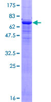 ACTC1 / Alpha Cardiac Actin Protein - 12.5% SDS-PAGE of human ACTC stained with Coomassie Blue