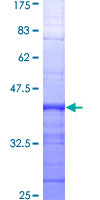 ACTC1 / Alpha Cardiac Actin Protein - 12.5% SDS-PAGE Stained with Coomassie Blue.