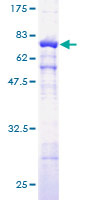 ACTG1 / Gamma Actin Protein - 12.5% SDS-PAGE of human ACTG1 stained with Coomassie Blue