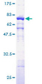 ACTG1 / Gamma Actin Protein - 12.5% SDS-PAGE of human ACTG1 stained with Coomassie Blue