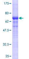ACTG2 Protein - 12.5% SDS-PAGE of human ACTG2 stained with Coomassie Blue