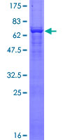 ACTG2 Protein - 12.5% SDS-PAGE of human ACTG2 stained with Coomassie Blue