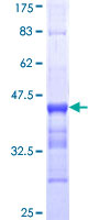 ACTG2 Protein - 12.5% SDS-PAGE Stained with Coomassie Blue.