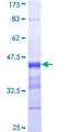 ACTG2 Protein - 12.5% SDS-PAGE Stained with Coomassie Blue.