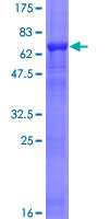 ACTL7B Protein - 12.5% SDS-PAGE of human ACTL7B stained with Coomassie Blue