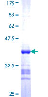 ACTL7B Protein - 12.5% SDS-PAGE Stained with Coomassie Blue.