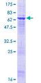 ACTL8 Protein - 12.5% SDS-PAGE of human ACTL8 stained with Coomassie Blue
