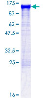 ACTN1 Protein - 12.5% SDS-PAGE of human ACTN1 stained with Coomassie Blue