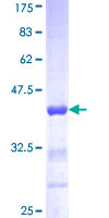 ACTN1 Protein - 12.5% SDS-PAGE Stained with Coomassie Blue.