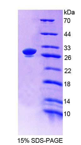 ACTN1 Protein - Recombinant Actinin Alpha 1 By SDS-PAGE