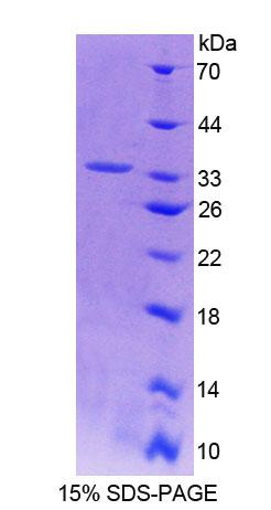 ACTN3 Protein - Recombinant  Actinin Alpha 3 By SDS-PAGE