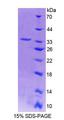 ACTN3 Protein - Recombinant  Actinin Alpha 3 By SDS-PAGE