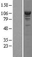 ACTN4 Protein - Western validation with an anti-DDK antibody * L: Control HEK293 lysate R: Over-expression lysate