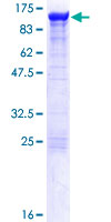 ACTN4 Protein - 12.5% SDS-PAGE of human ACTN4 stained with Coomassie Blue