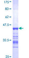 ACTN4 Protein - 12.5% SDS-PAGE Stained with Coomassie Blue.