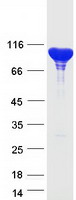 ACTN4 Protein - Purified recombinant protein ACTN4 was analyzed by SDS-PAGE gel and Coomassie Blue Staining