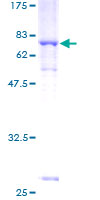 ACTR1A / Centractin Protein - 12.5% SDS-PAGE of human ACTR1A stained with Coomassie Blue