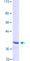 ACTR1B Protein - 12.5% SDS-PAGE Stained with Coomassie Blue.