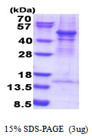 ACTR3 Protein