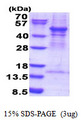 ACTR3 Protein