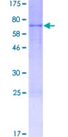 ACTR3B / ARP4 Protein - 12.5% SDS-PAGE of human ACTR3B stained with Coomassie Blue