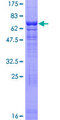 ACTR6 Protein - 12.5% SDS-PAGE of human ACTR6 stained with Coomassie Blue